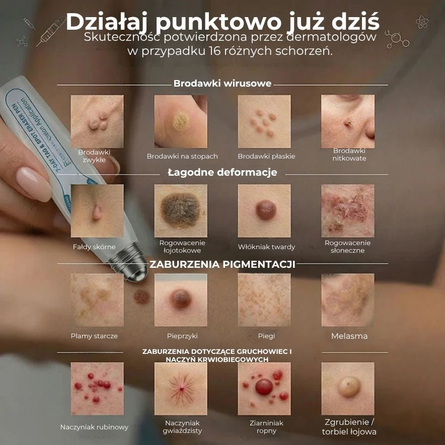 Zaawansowany wałek do usuwania brodawek skórnych i zwykłych