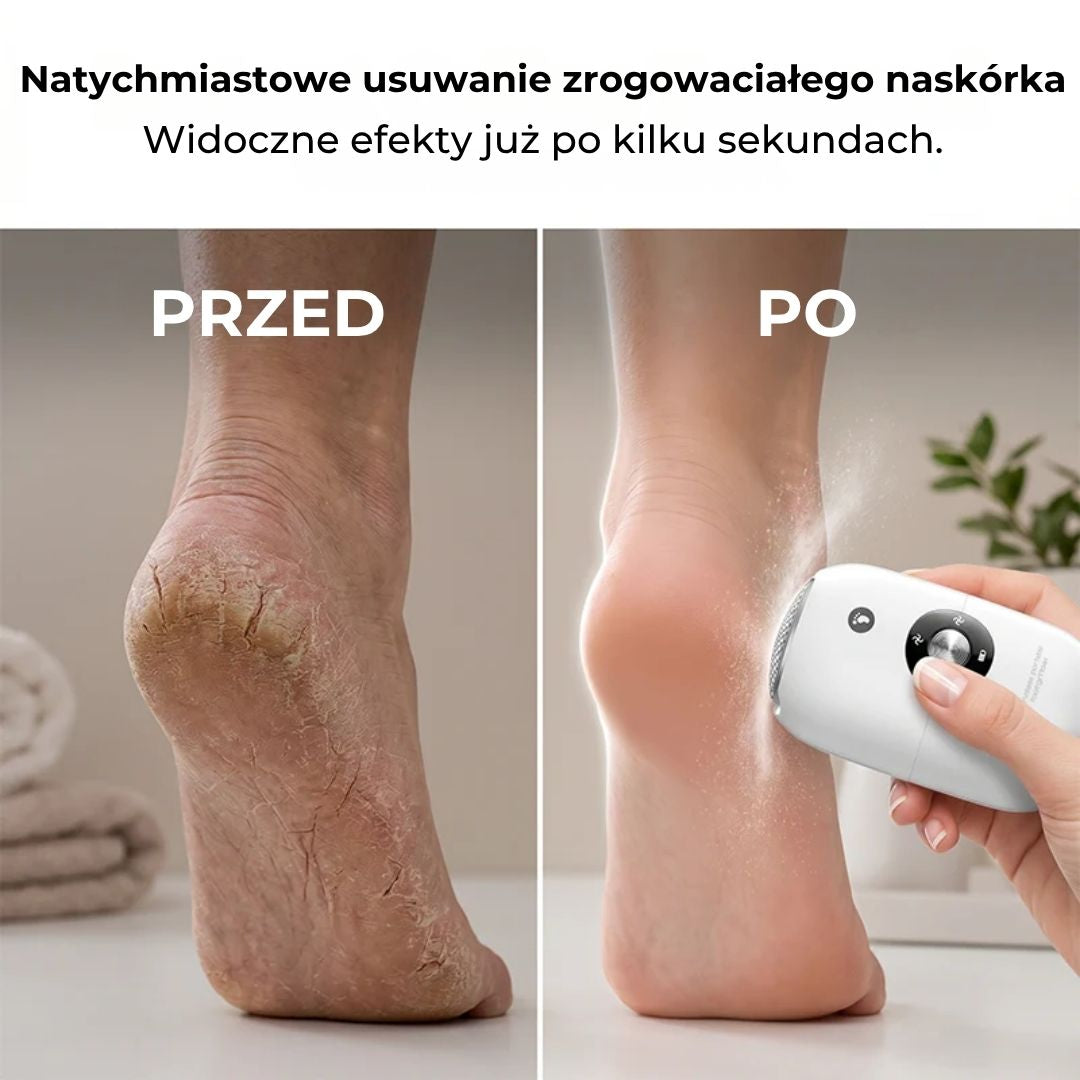 Automatyczna szlifierka do pedicure