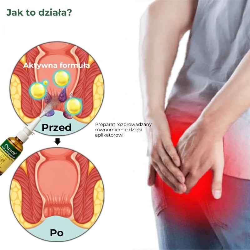 Ziołowy spray na hemoroidy