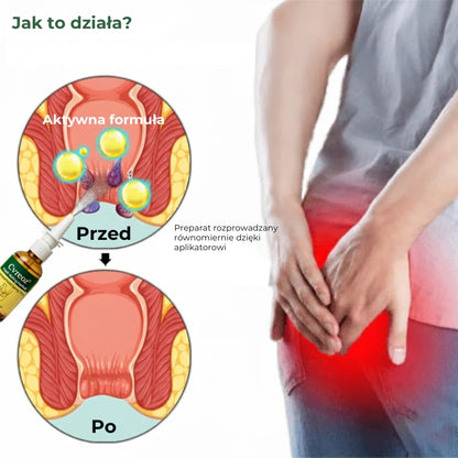 Ziołowy spray na hemoroidy