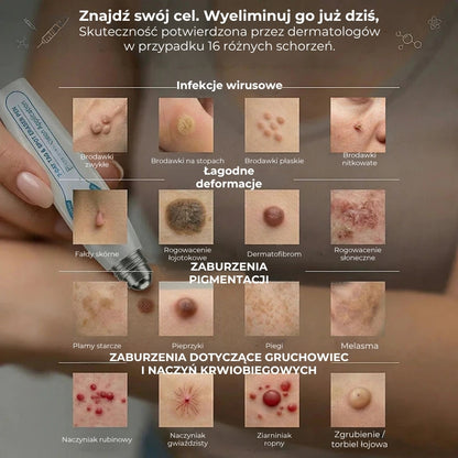 Zaawansowany wałek do usuwania brodawek skórnych i zwykłych