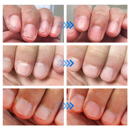 Leczniczy i oczyszczający żel do naprawy paznokci