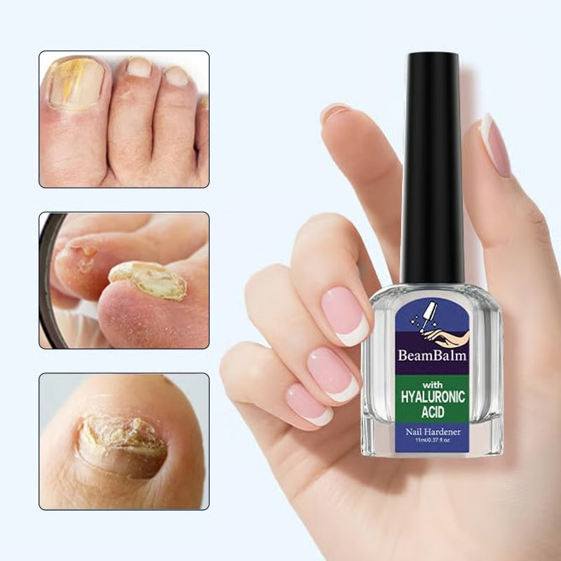 Leczniczy i oczyszczający żel do naprawy paznokci