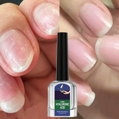 Leczniczy i oczyszczający żel do naprawy paznokci